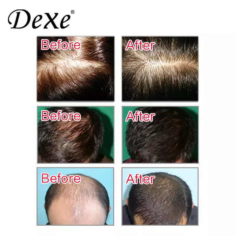 Dexe Anti-Hair Loss Shampoo 7oz back label