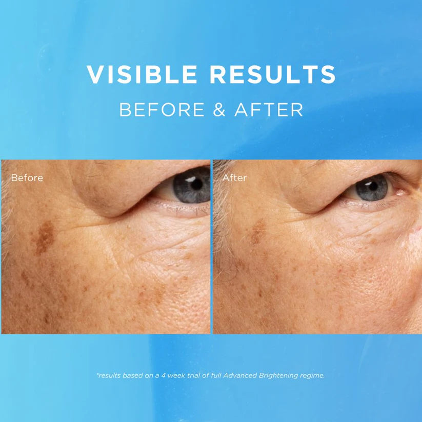 Fade Out Advanced Brightening Day Cream SPF 20