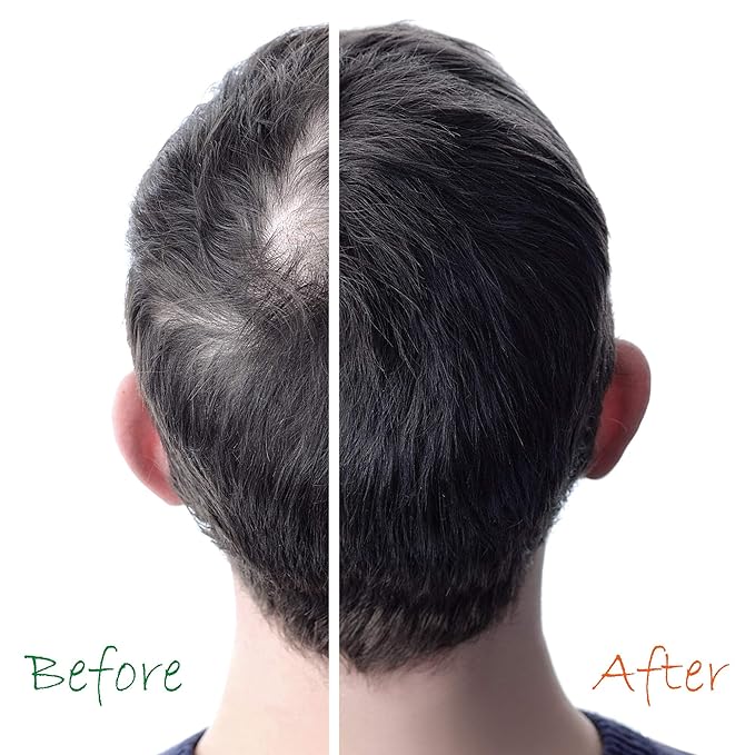 Energisant capillaire bio - Stimulateur de pousse des cheveux - Provitamine B5 - 59 ml